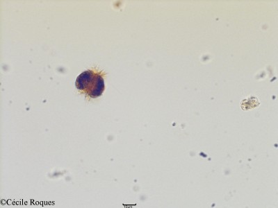 protozoo/Mesodinium rubrum (1)(copy)_thumb.jpg